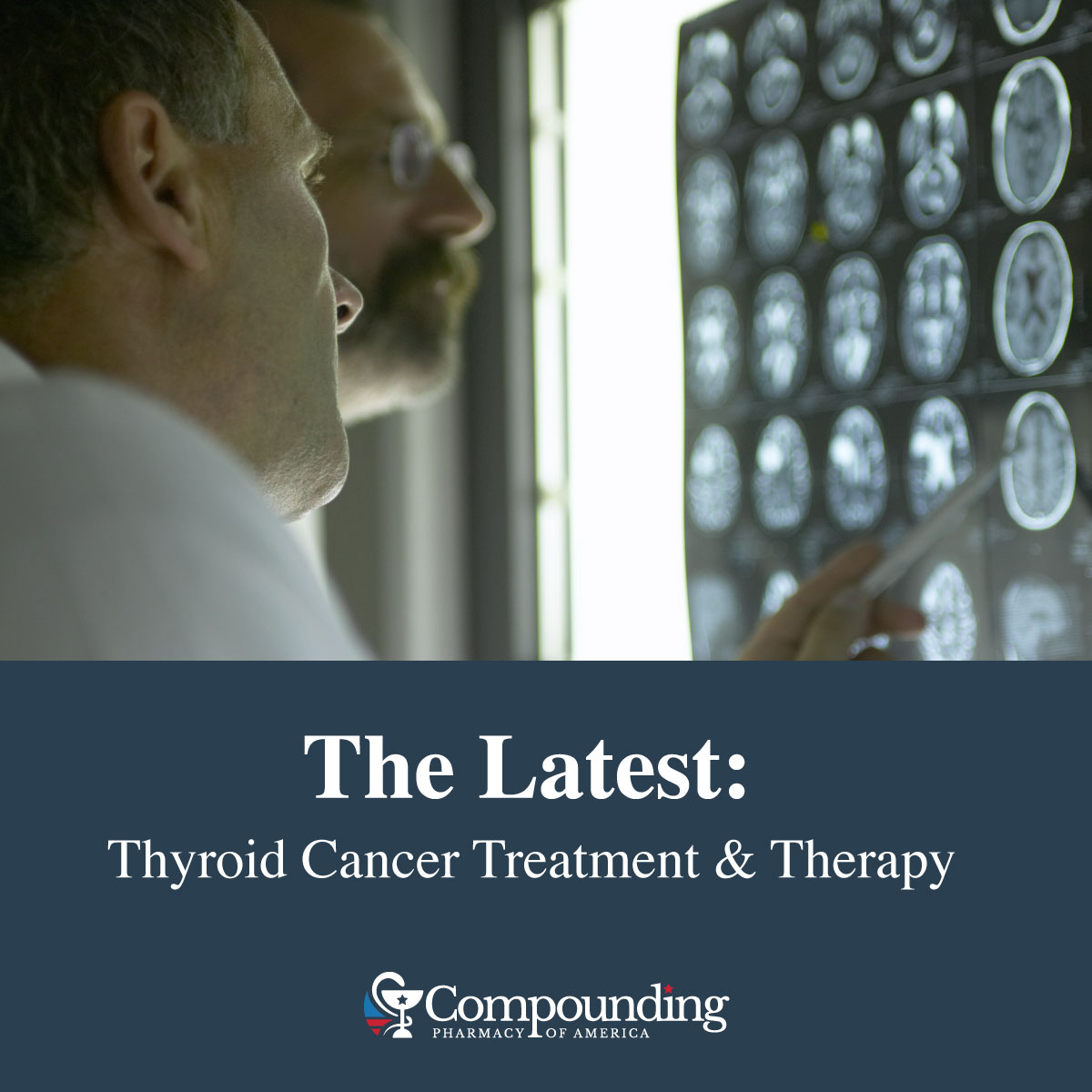 The Latest in Thyroid Cancer Medications and Treatment