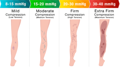 TED Hose: Best Recommended Guide to TED Stockings vs Compression Socks