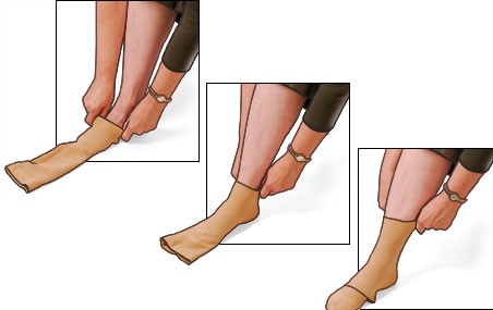 Putting on Compression Stockings - Step-by-Step (with Pictures!)
