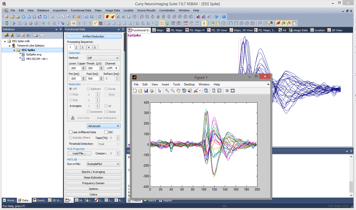 Using Matlab with Curry 7 Compumedics Neuroscan