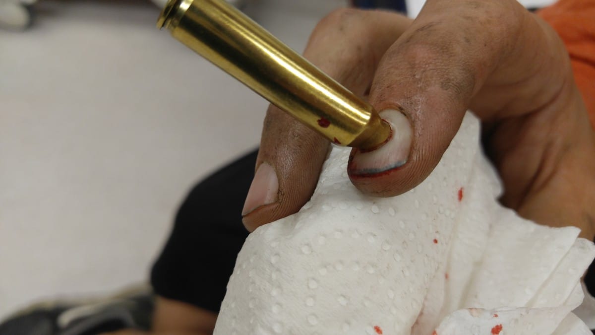 [VIDEO] *WARNING GRAPHIC* Man Has Finger Impaled By Bullet Casing