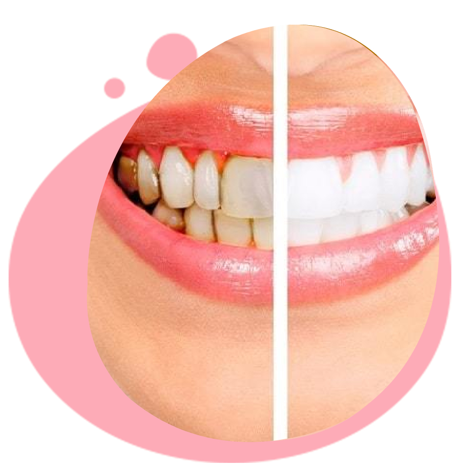 Top 10 dentist in India Best dentist near me