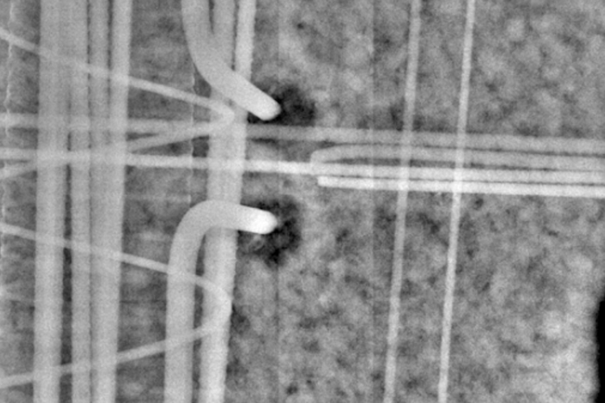 XRay Services Conview Company Inc.