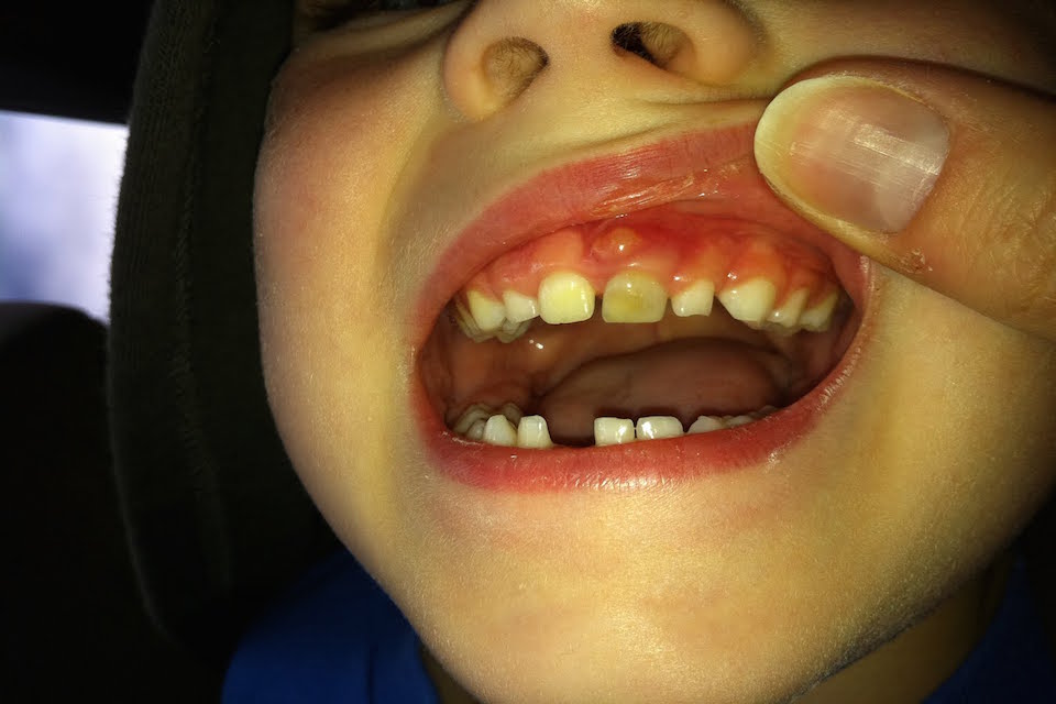 The best dental and gum care services in Kolkataonly at