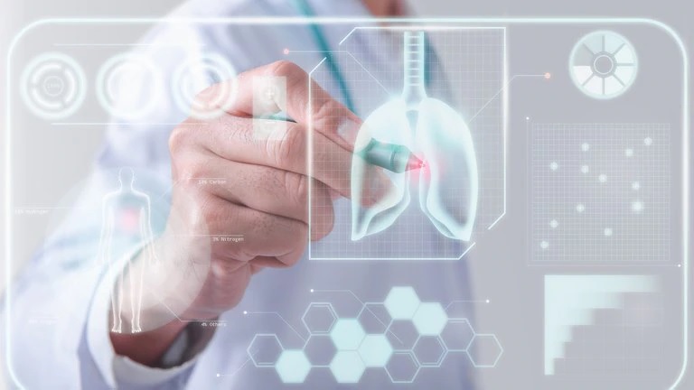 Más del 30 de hospitalizados por COVID19 tienen impacto pulmonar un