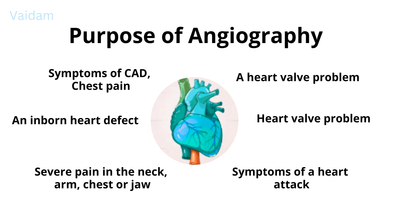 Angiography Cost In South Africa Updated 2024