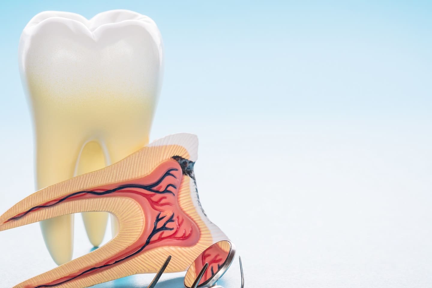 What Treating Tooth Decay Really Means Conroe, TX