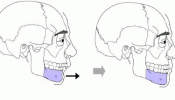 Les Adenopathies Cervicofaciales Conseil Dentaire Dr Hauteville
