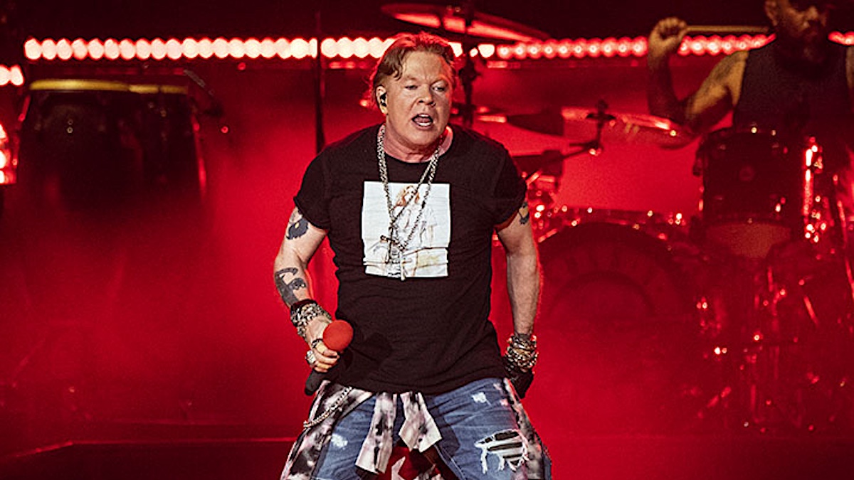 Axl Rose Before And After