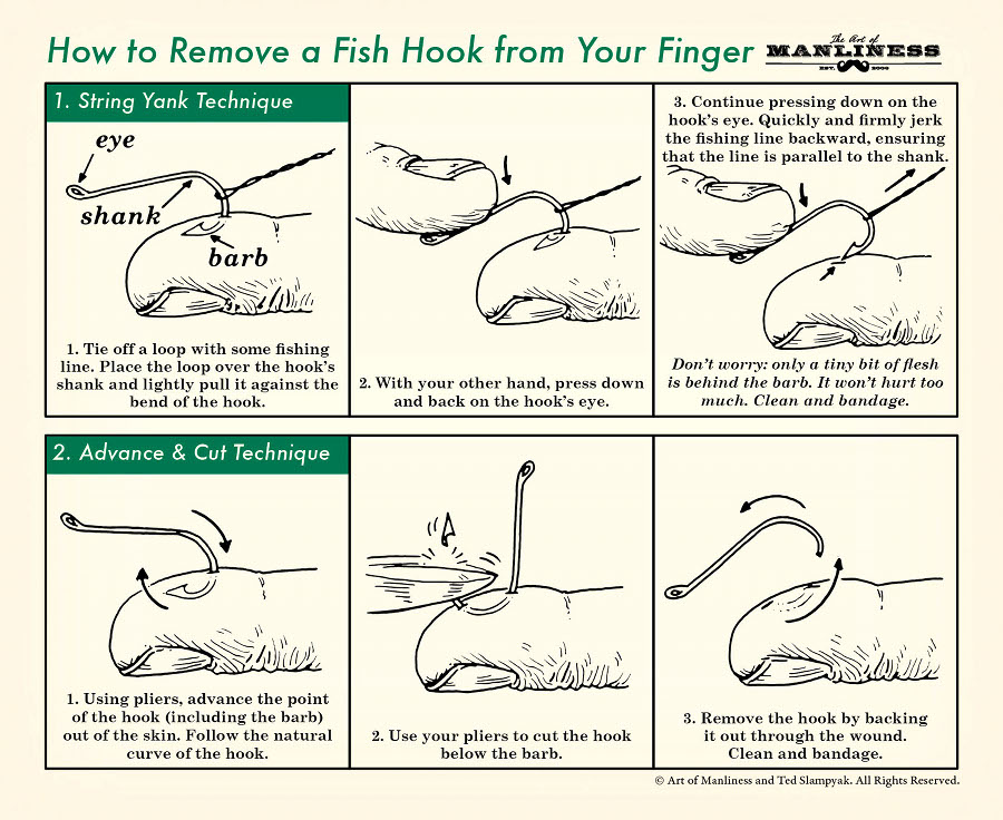 How To Remove A Fish Hook | The Art Of Manliness