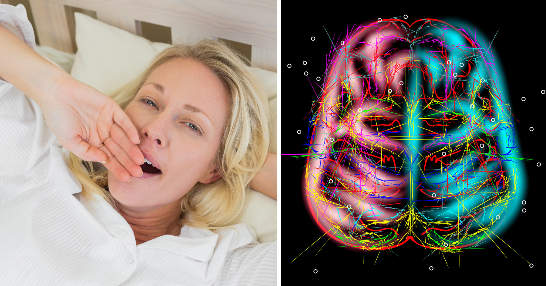 Why Are Yawns Contagious? ATTN