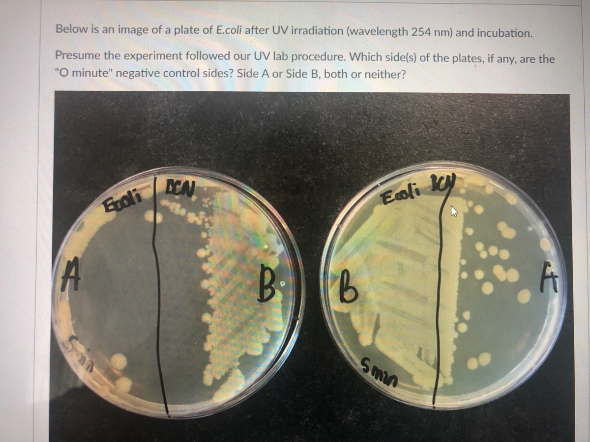 E Coli Plate