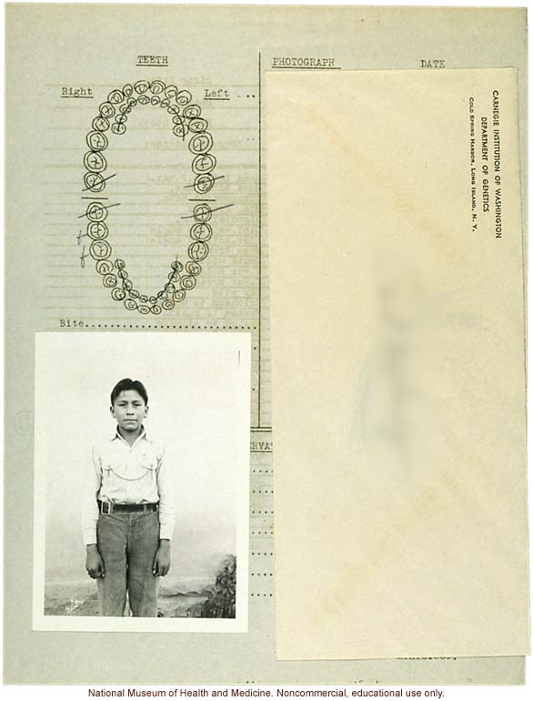 "Growing Series" of Navajo Male age 818, Tuba City and Ganado, Arizona (anthropometry, dental