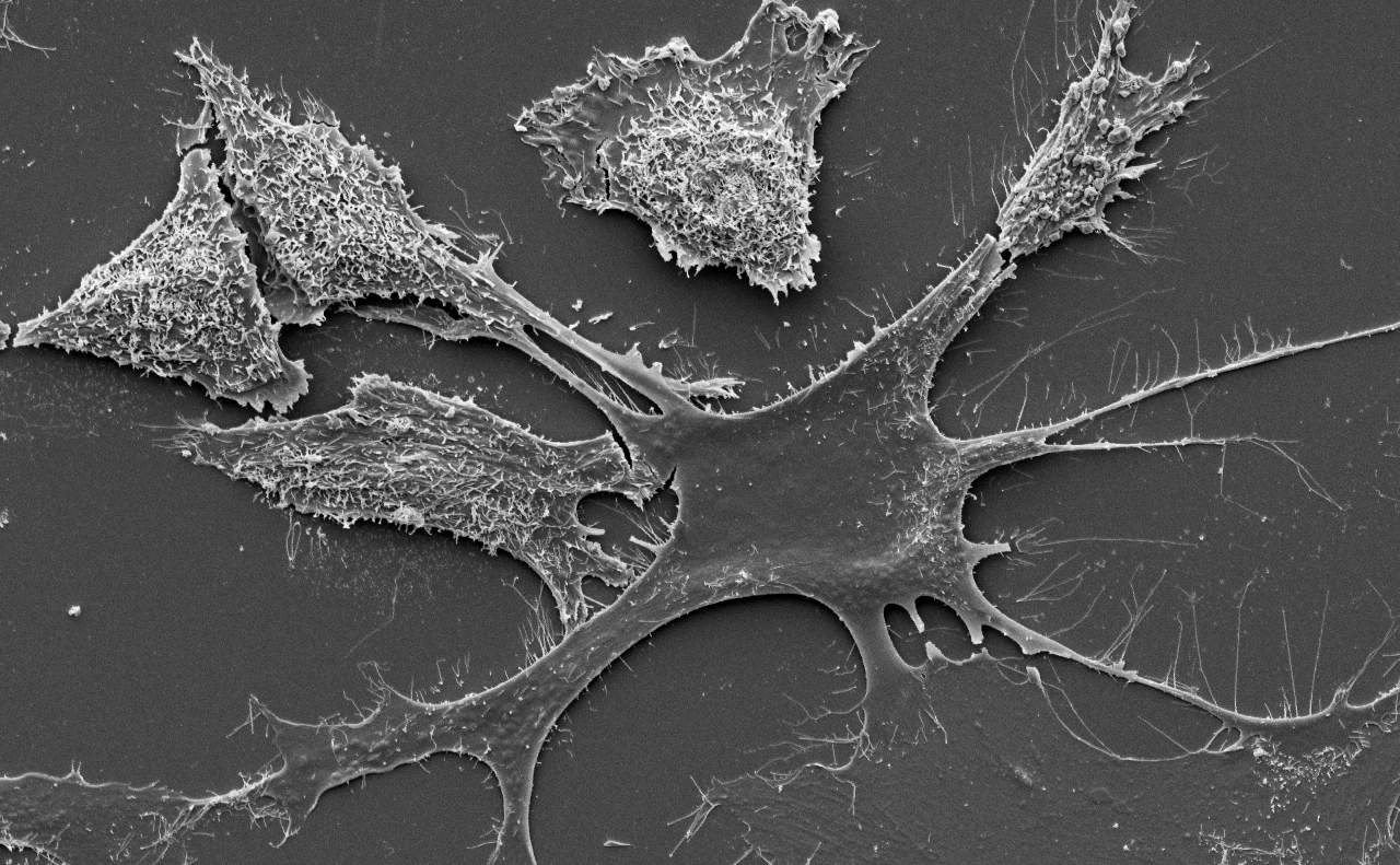 Cancer Cell Electron Microscopy