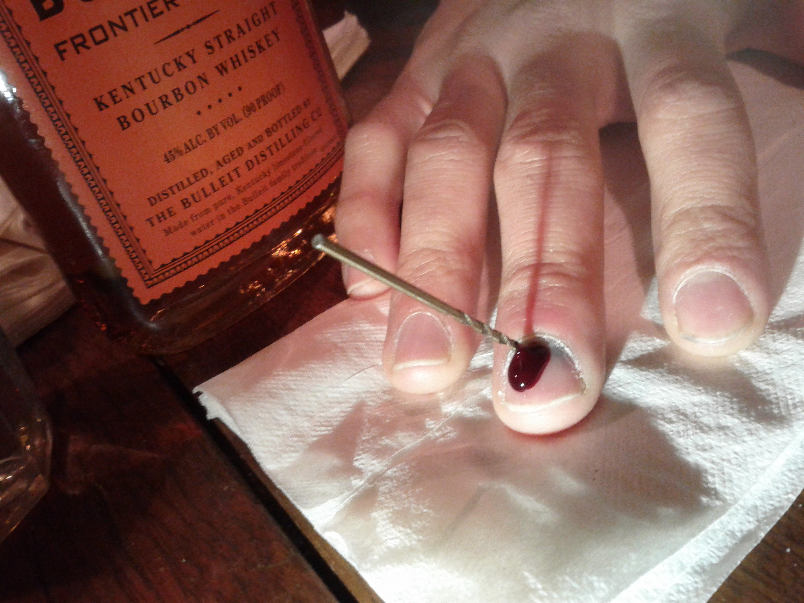 Details 109+ dried blood under nail latest noithatsi.vn