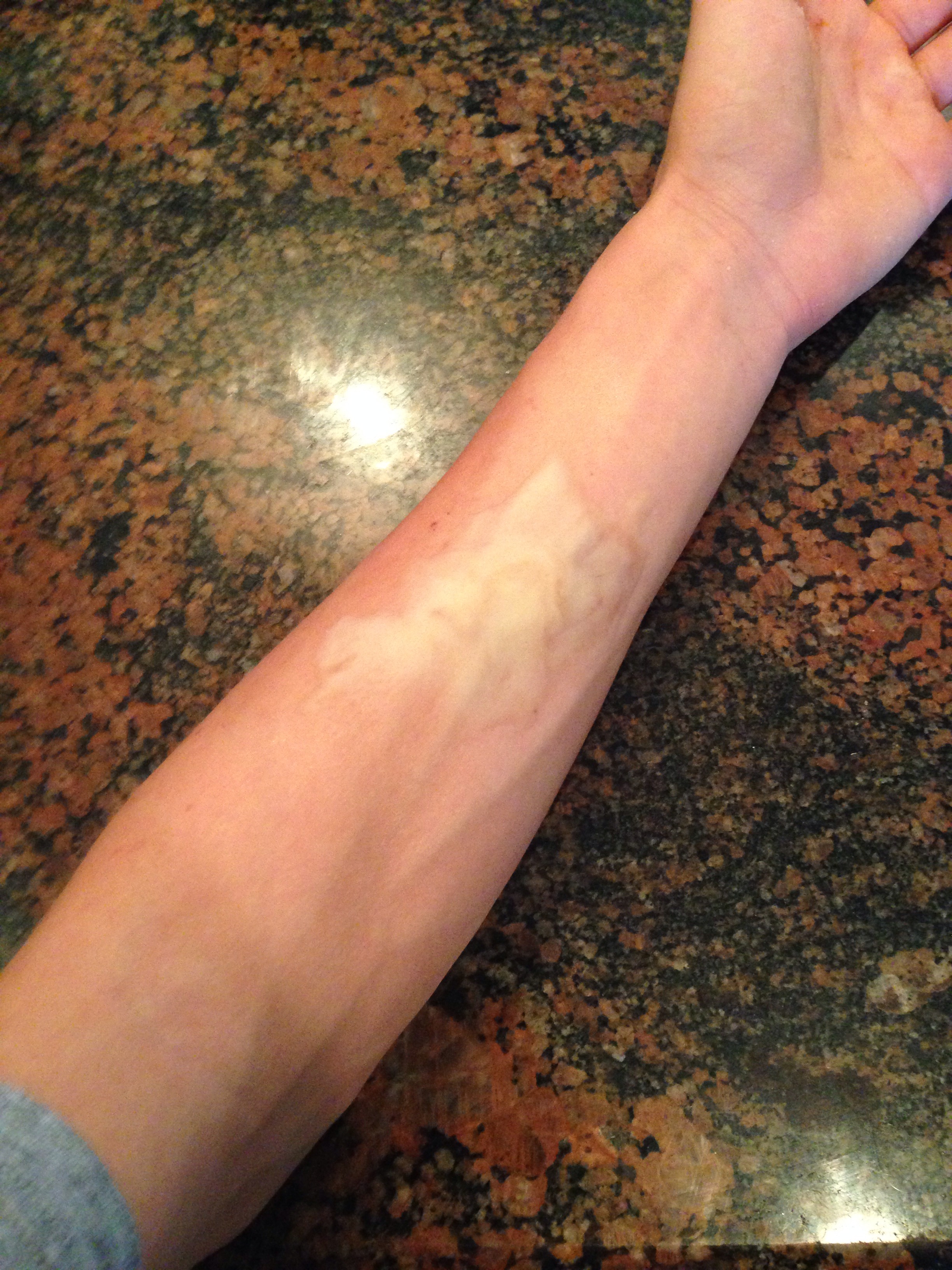 Fake Wounds From Vaseline 3 Steps Instructables