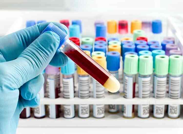 Asha 4D Diagnostics Reviews, 100 Bed Hospital Road, Hospet 34 Ratings