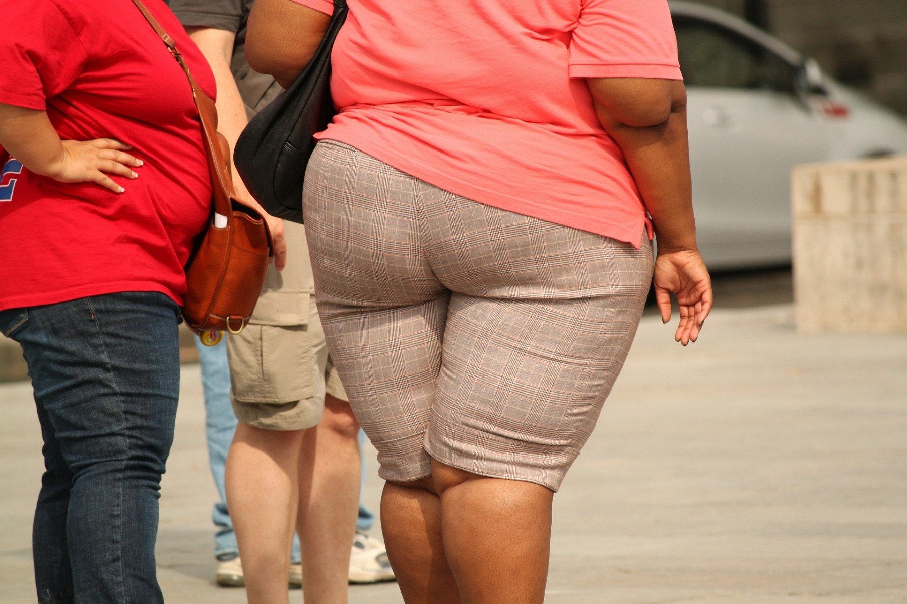 Weight loss surgery for obese women prevents womb cancer