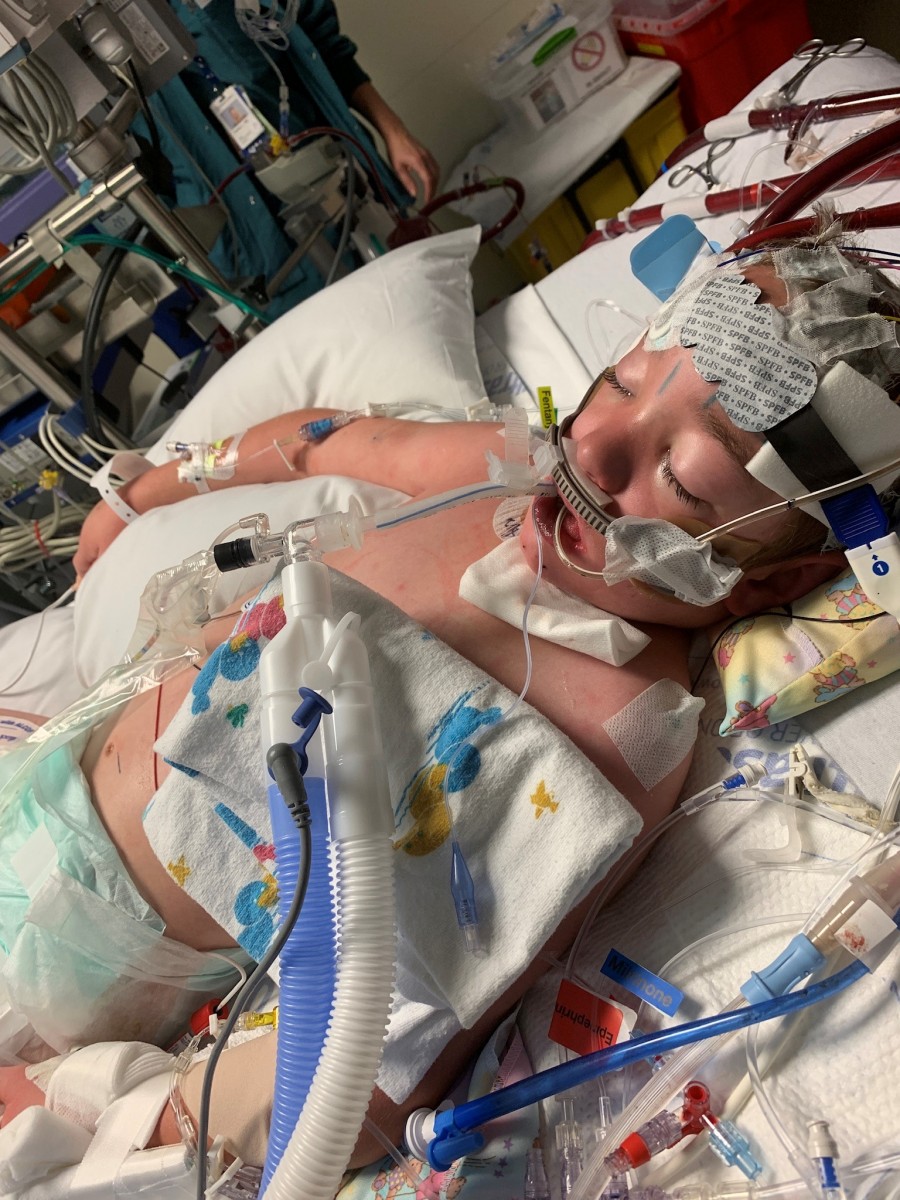 After reaching its 1,000th ECMO run, Children’s Mercy team reflects on