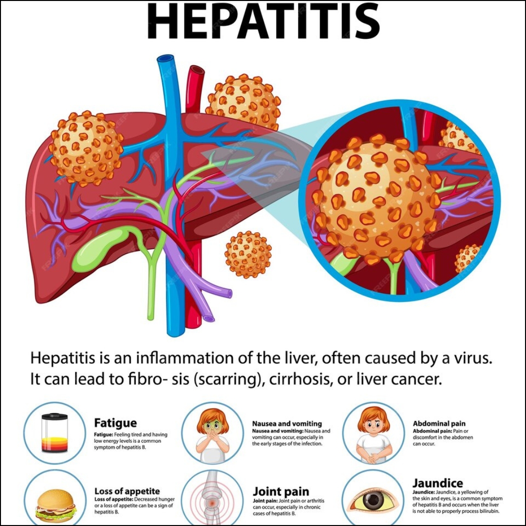 All you need to know about Hepatitis