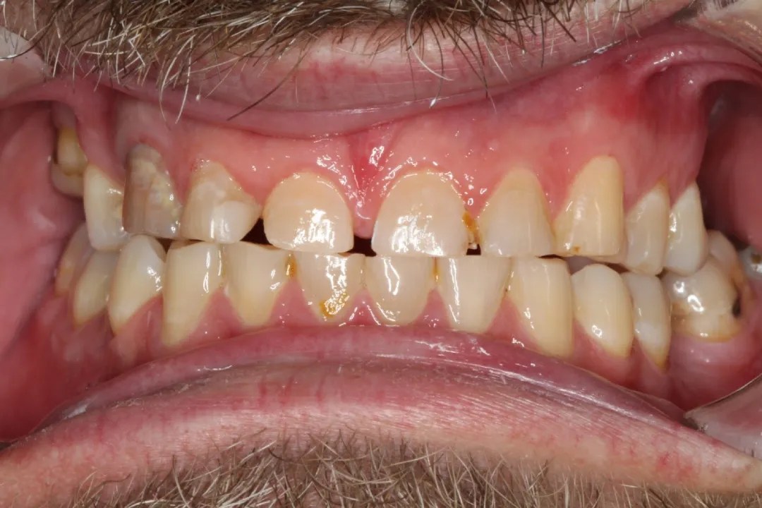 Coloured Sands Clinic Friendly Cooloola Cove Dentist