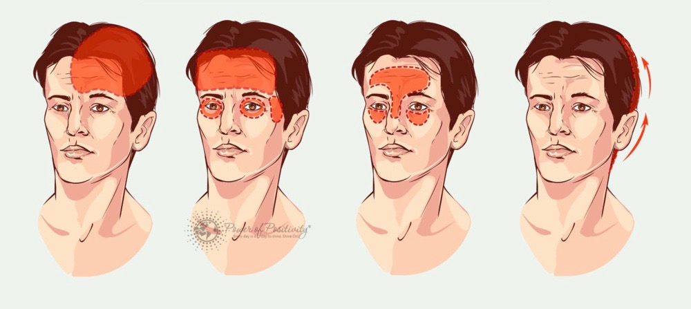 Vous ne devez jamais ignorer ces 4 types de maux de tête! Cocktail