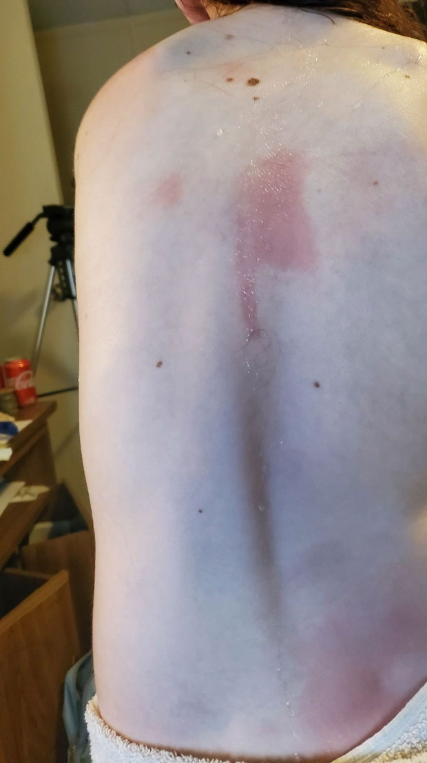 Cette jeune Américaine de 12 ans est allergique… à l’eau