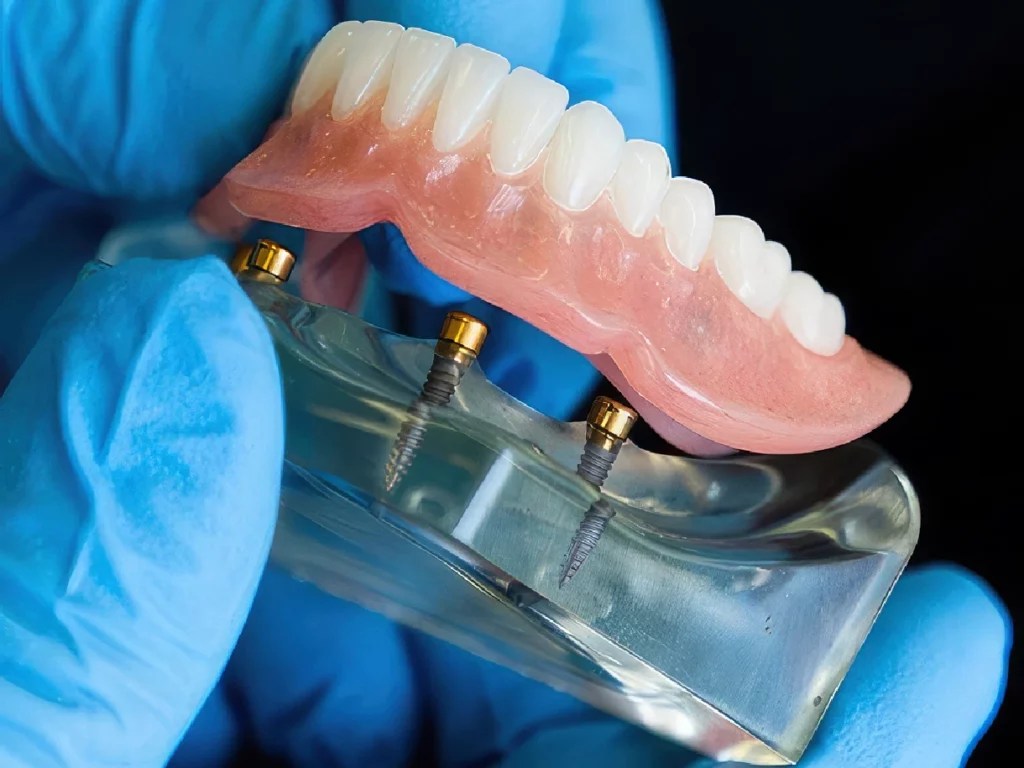 SnapIn Implant Dentures Cordova Dentures & Implants