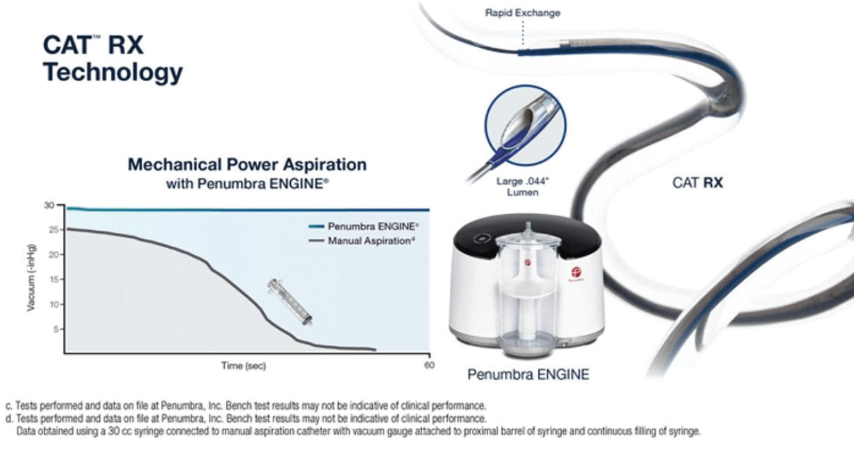 New Evidence Supports Continuous Power Aspiration With Indigo® System