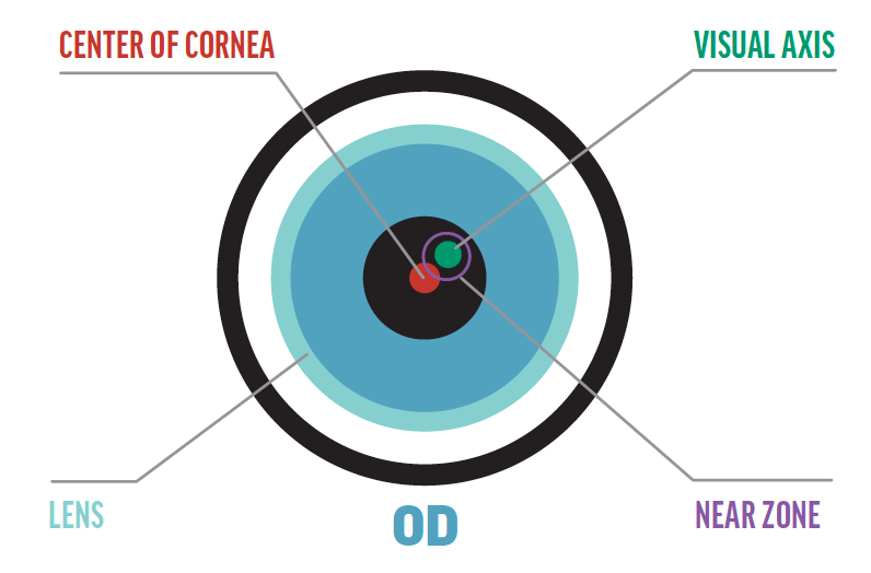 New Improvements in Multifocal Scleral Lens Technology Modern Optometry