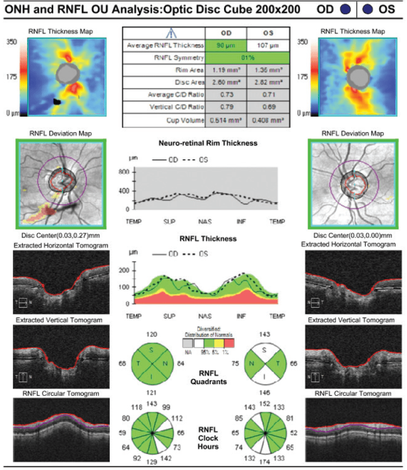 Diagnosis, Treatment, and Scope a Review Modern Optometry