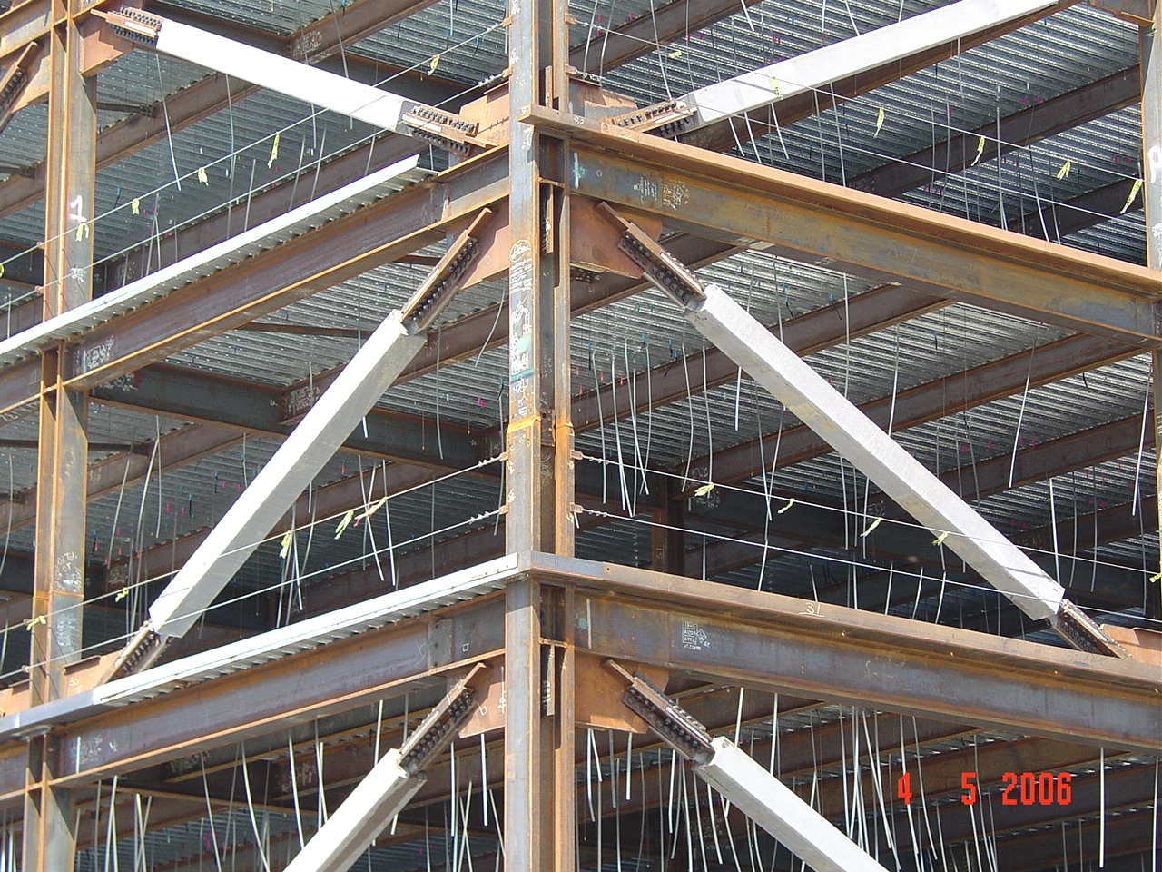 Kaiser Vallejo Medical Center CoreBrace