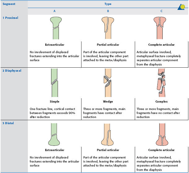 Proximal Humerus Fracture Core EM
