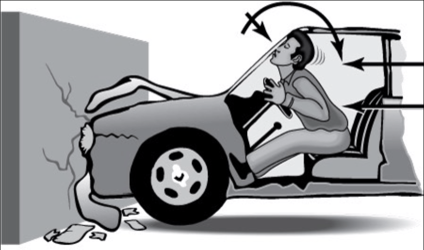 CSpine Injuries + CT Interpretation Core EM