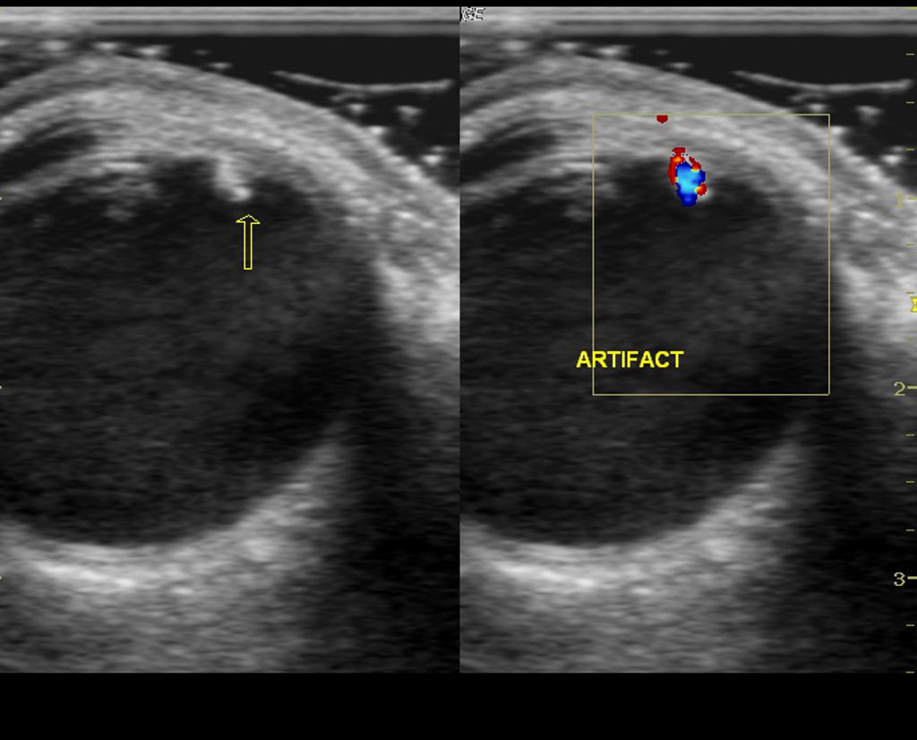 Ocular Ultrasound Core EM