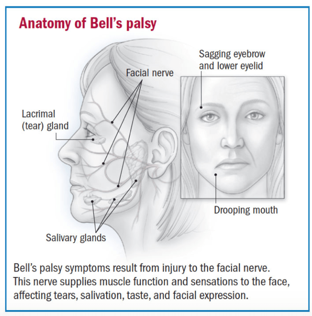 Bell's Palsy Anatomy