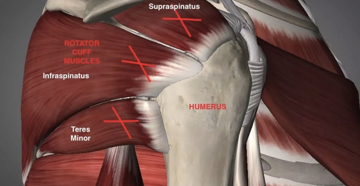 Rotator cuff physical therapy Omaha C.O.R.E. Physical Therapy and Sports Performance
