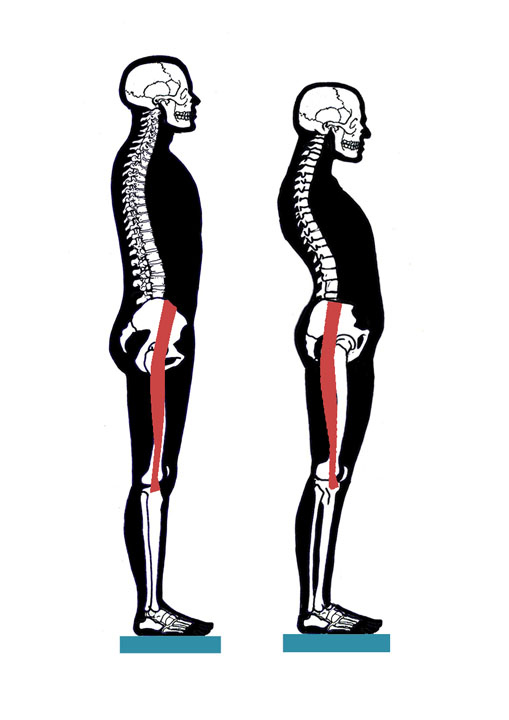IT Band Problems Why Does My Hip Hurt?
