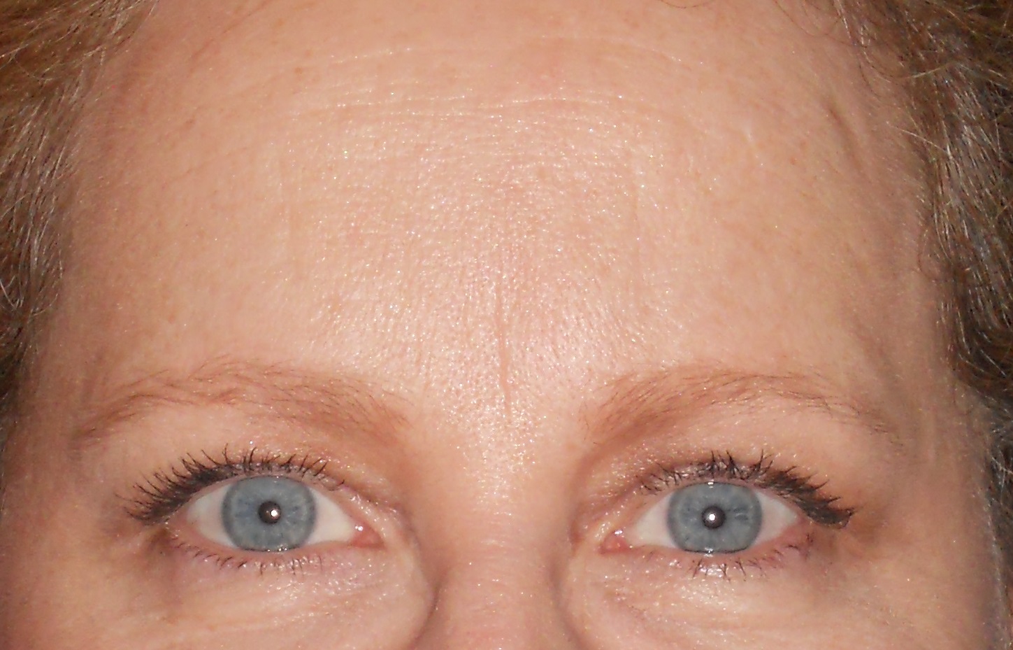 Will a dent come out of your head??? cornfedcontessa