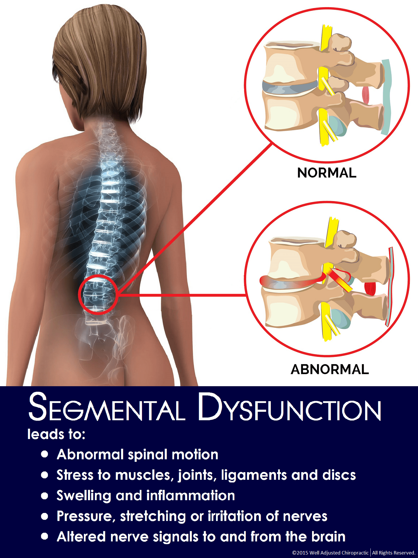 What is a segmental dysfunction? Chiropractor Kota Kemuning