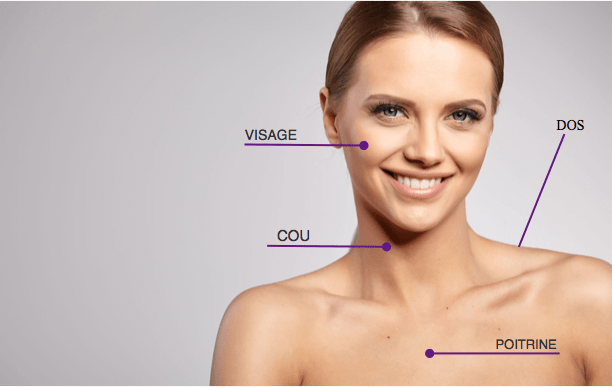 PhotoRajeunissement IPL / Laser
