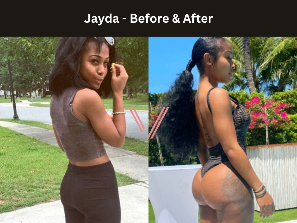 Celebrities With Brazilian Butt Lift 60 Photos Moonagedaydream.film