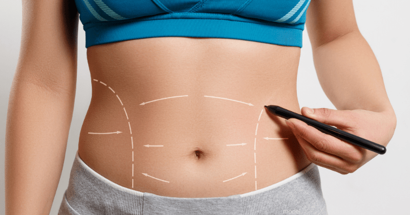 Tummy Tuck Prices in Ohio Cosmetic Surgery Tips