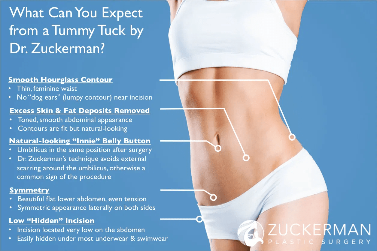 Tummy Tuck Cost in Minnesota Cosmetic Surgery Tips
