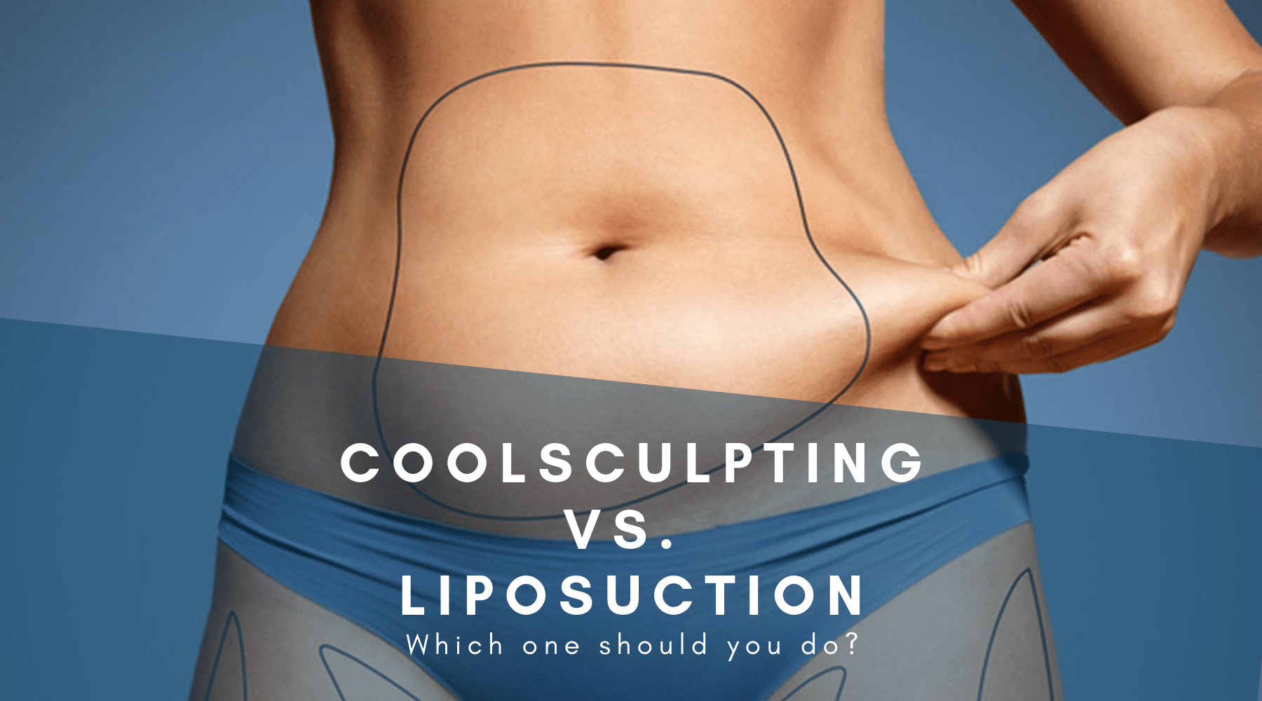 Liposuction Versus Coolsculpting Cosmetic Surgery Tips