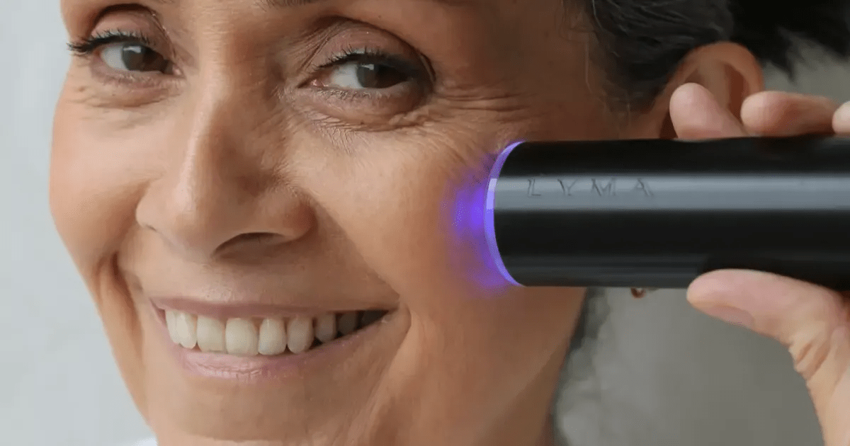 Home Laser for Age Spots Cosmetic Surgery Tips