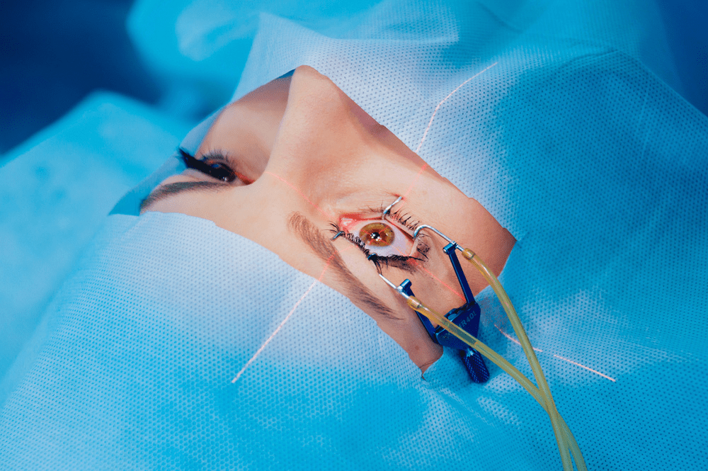 Average Cost of Laser Iridotomy Cosmetic Surgery Tips
