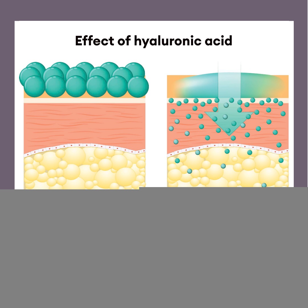 Hyaluronic Acid untuk Apa?
