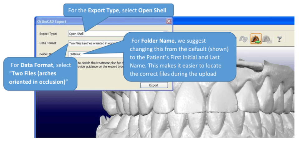 Itero STL export