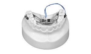Fixed Leaf Expander